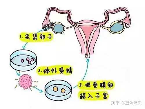 囊胚 试管婴儿选择性别吗?关于试管你不知道的事