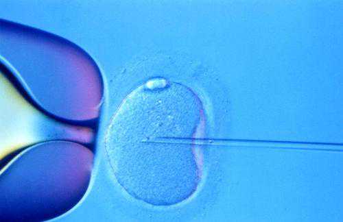 囊胚 试管婴儿选择性别吗?关于试管你不知道的事