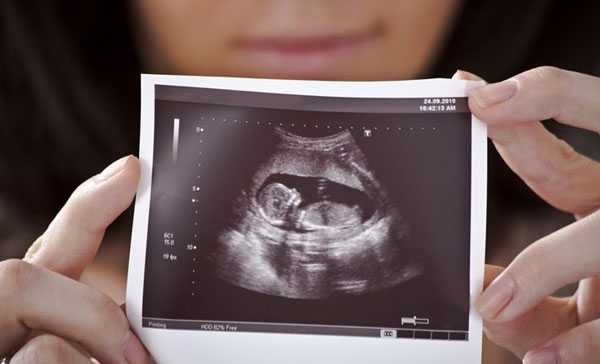 试管儿染色体异常_子宫切除会怀孕_最新全国三代试管婴儿资质医院汇总（附医