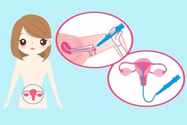 染色体异常和胎停_女宝宝切除子宫_输卵管通而不畅除了做试管婴儿，还有其他