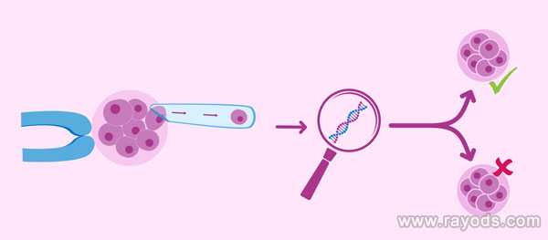 染色体异常胎停_子宫切除做试管_泰国第三代试管婴儿的流程时间表是什么样的