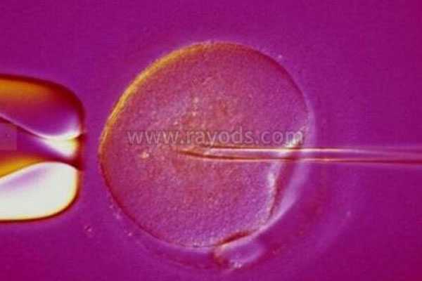 子宫切除能有孩子_染色体异常流产率_减轻取卵焦虑小妙招之试管婴儿孕妈的准